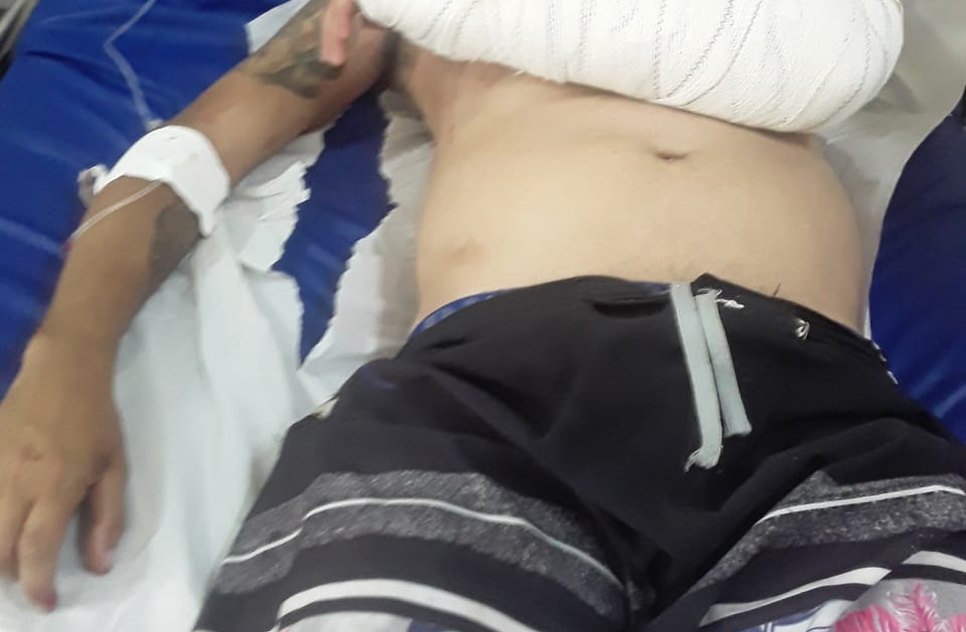Entregador é espancado por seguranças de seresta e fica hospitalizado em Itabaiana