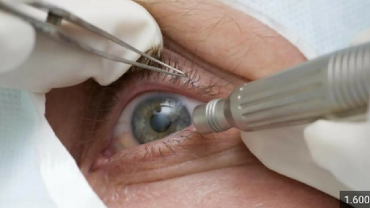 Todo mundo pode usar lente de contato colorida? Médico alerta para riscos do acessório, comum no Halloween
