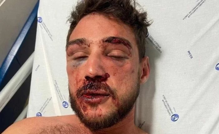 O alagoano Luis foi agredido por seguranças de um bar