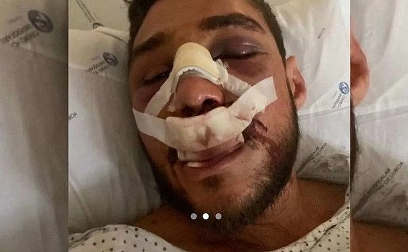 Alagoano denuncia agressões de seguranças contra ele e companheiro em bar de Lisboa