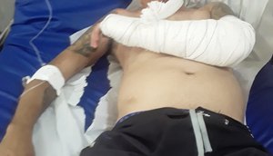 Entregador é espancado por seguranças de seresta e fica hospitalizado em Itabaiana