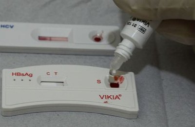 Casos de sífilis voltam a aumentar no Brasil