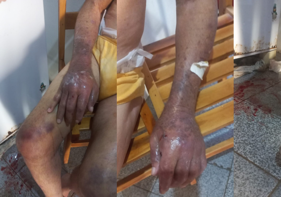 Filha é presa suspeita de maus-tratos após idoso ser encontrado em situação de risco no interior de Alagoas
