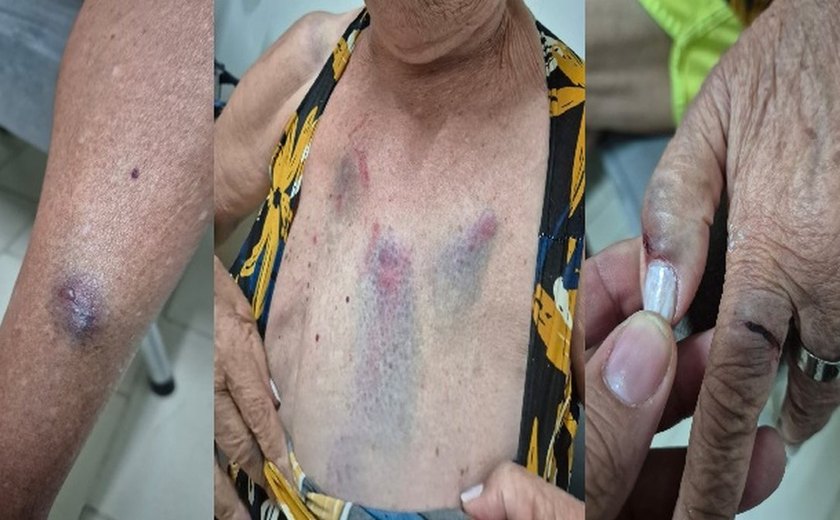Ministério Público denuncia médica por agressão e lesão contra idosa de 77 anos em Arapiraca