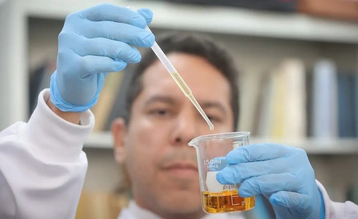 País registra 15 õbitos por intoxicação por metanol em bebida País registra 15 õbitos por intoxicação por metanol em bebida