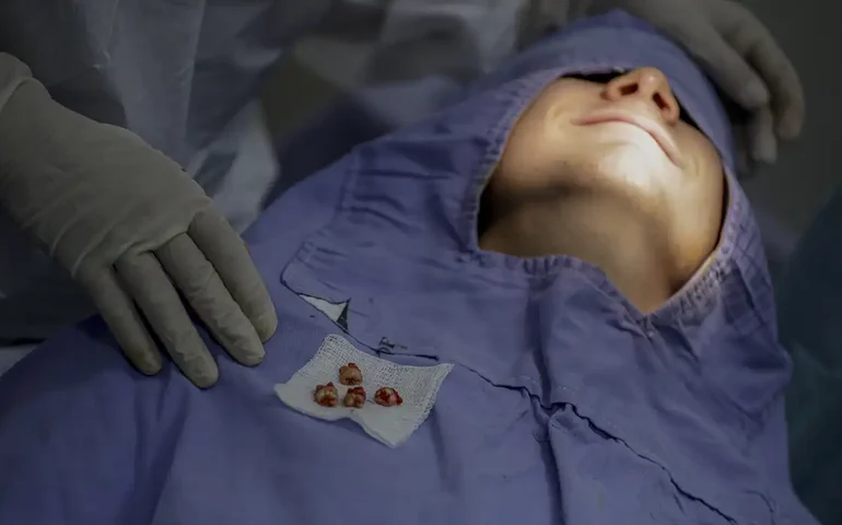 Tratar canal dentário pode beneficiar a saúde geral, aponta estudo