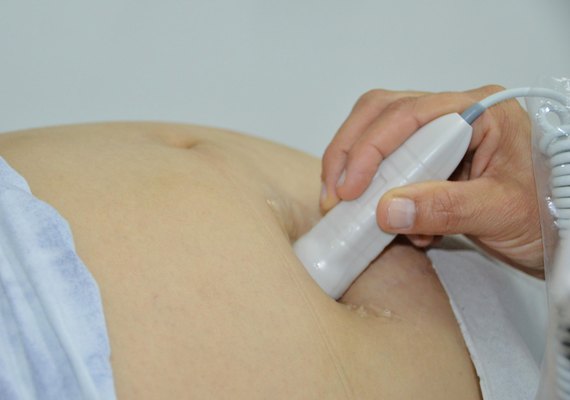Secretaria de Estado da Saúde abre inscrições para o IX Fórum Perinatal de Alagoas de 2024