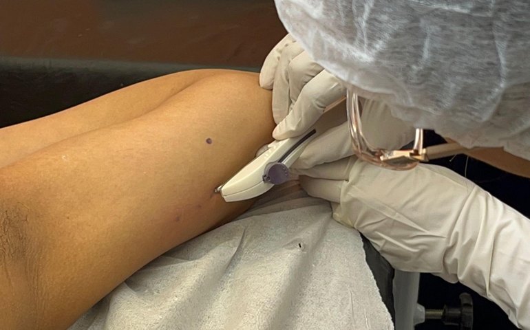 Secretaria da Primeira Infância realiza capacitação para inserção do Implanon em Rio Largo