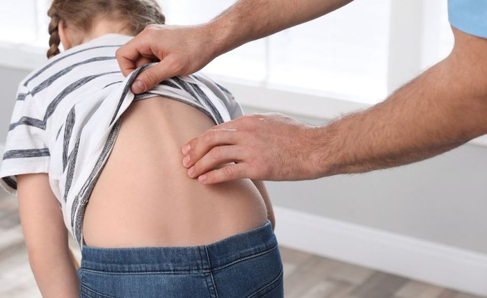 Mochila pesada pode comprometer a saúde de crianças e adolescentes, alerta ortopedista Mochila pesada pode comprometer a saúde de crianças e adolescentes, alerta ortopedista