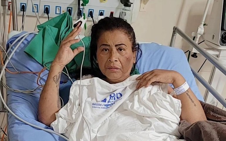 Mc Katia passa por segunda amputação devido a complicações de cirurgia