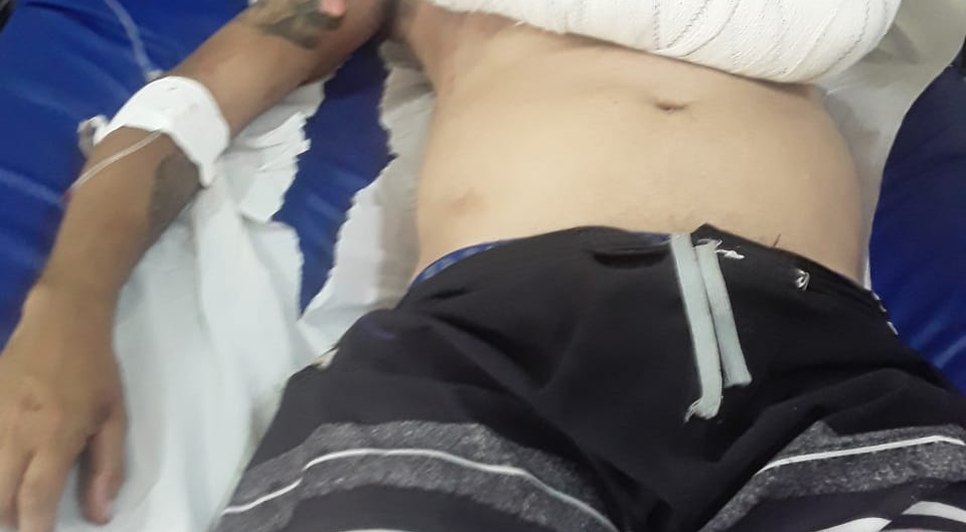 Entregador é espancado por seguranças de seresta e fica hospitalizado em Itabaiana