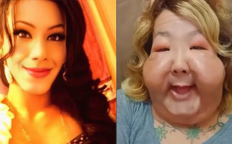 Juju do Pix passa por nova cirurgia para retirada de óleo mineral do rosto