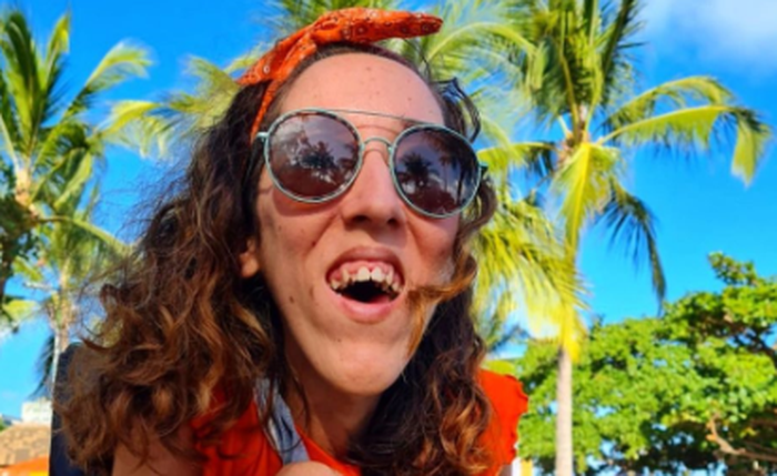 Vanessa de Oliveira luta para reduzir preconceito contra pessoa com deficiência