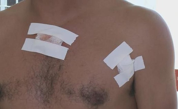 Motorista de aplicativo sobreviveu após ser baleado durante discussão