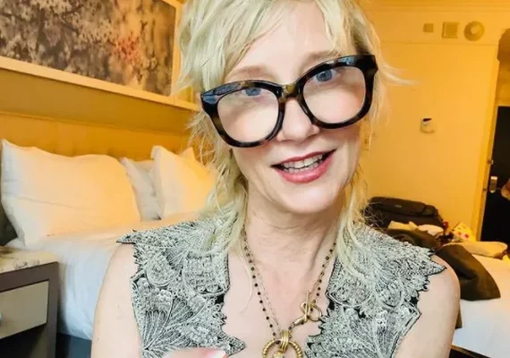 Anne Heche tem morte cerebral declarada e aparelhos serão desligados nas próximas horas, revela família