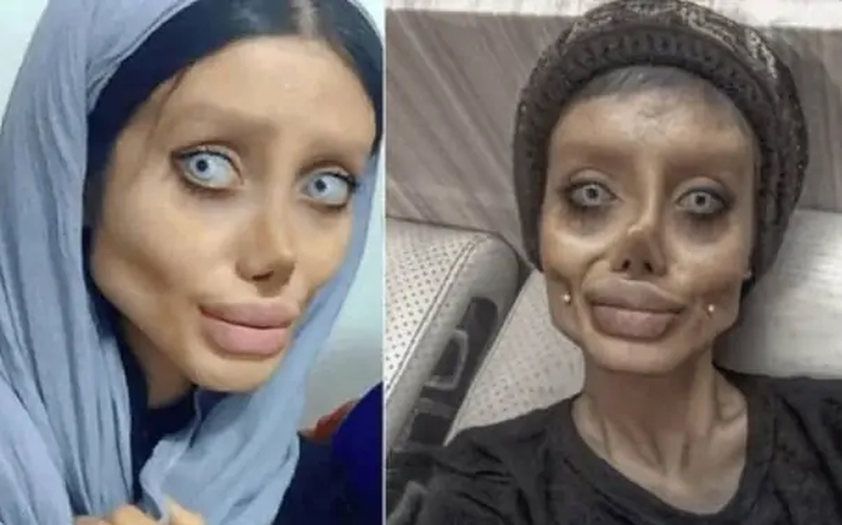 ‘Angelina Jolie Zumbi’ revela seu rosto pela 1ª vez após deixar prisão no Irã