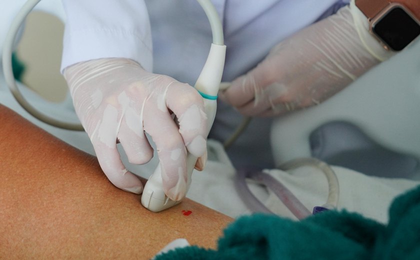 Médica do Hospital Metropolitano de Alagoas alerta para os riscos da esteatose hepática