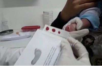 Teste do pezinho auxilia diagnóstico precoce de doenças em bebês
