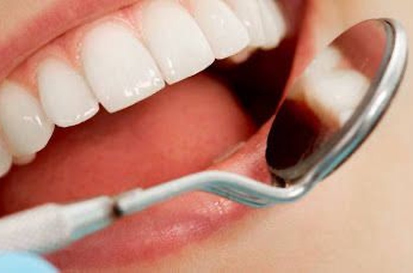 Maio Vermelho alerta para a importância da prevenção e do diagnóstico precoce do câncer bucal