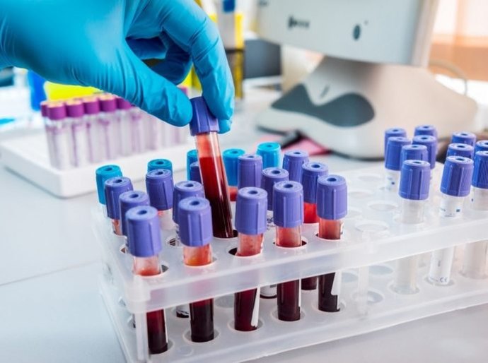 SMS organiza mutirão de exames clínicos para zerar demanda