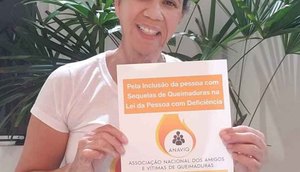 QUEIMADURA / Foto: Assessoria CHANGE.ORG Brasil