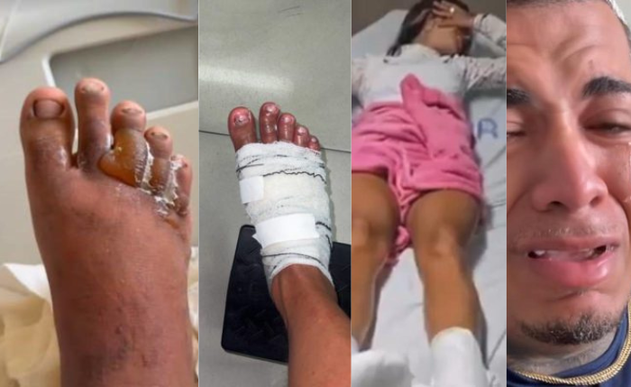 MC Thammy  e Arthur Brás sofreram queimaduras nos pés durante prova de reality show de Anderson Neiff