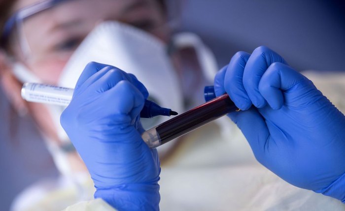 Paciente com coinfecção de Sars-CoV-2 e influenza são 4 vezes mais propensos à internações em UTIs Paciente com coinfecção de Sars-CoV-2 e influenza são 4 vezes mais propensos à internações em UTIs