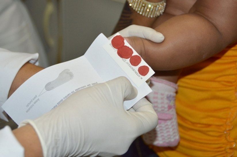 Sesau orienta técnicos municipais sobre importância do Teste do Pezinho