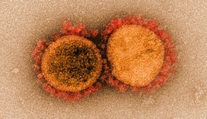 Ministério da Saúde confirma primeiro caso da subvariante Ômicron XE no Brasil; entenda / Foto: Foto: National Reprodução/Institute Of Allergy and Infectious Diseases