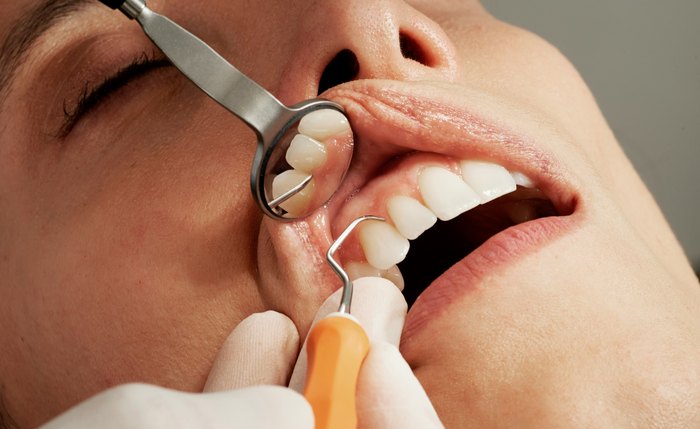 No Dia Mundial do Sorriso, dentista da Hapvida Interodonto destaca a importância de pacientes ficarem atentos a sinais como sangramento e lesões na boca