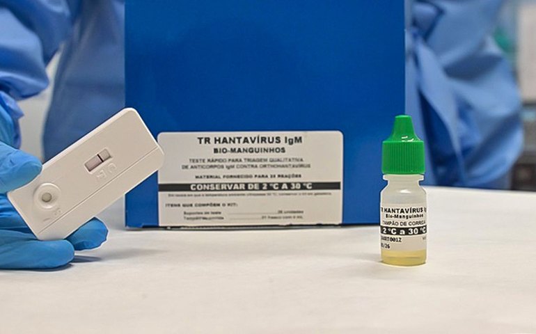 Novo teste permite diagnóstico rápido da hantavirose em 20 minutos
