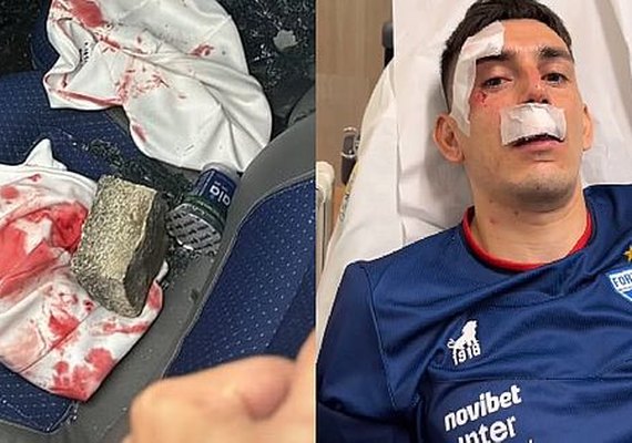Ônibus do Fortaleza é atacado e jogadores ficam feridos