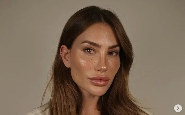 Romana Novais surpreende seguidores ao expor exagero em montagem sobre harmonização facial