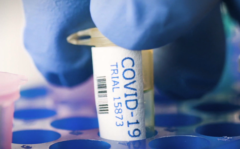 Ministério da Saúde ampliará processamento de testes para Covid-19