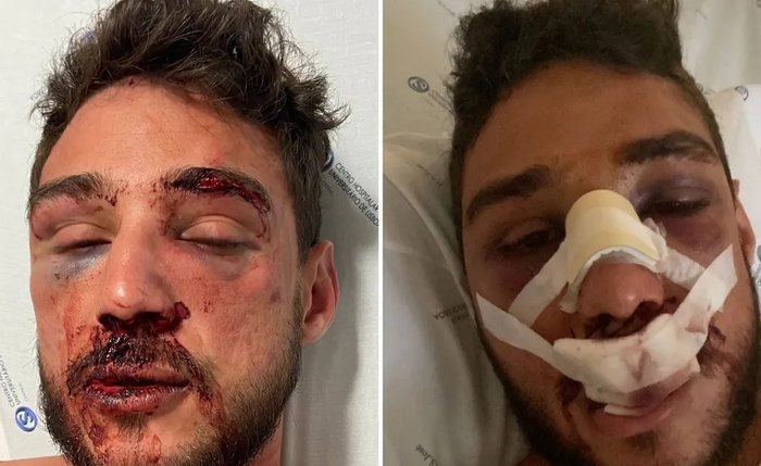 Alagoano Jefferson Tenório, de 29 anos, foi brutalmente espancado em Lisboa Alagoano Jefferson Tenório, de 29 anos, foi brutalmente espancado em Lisboa