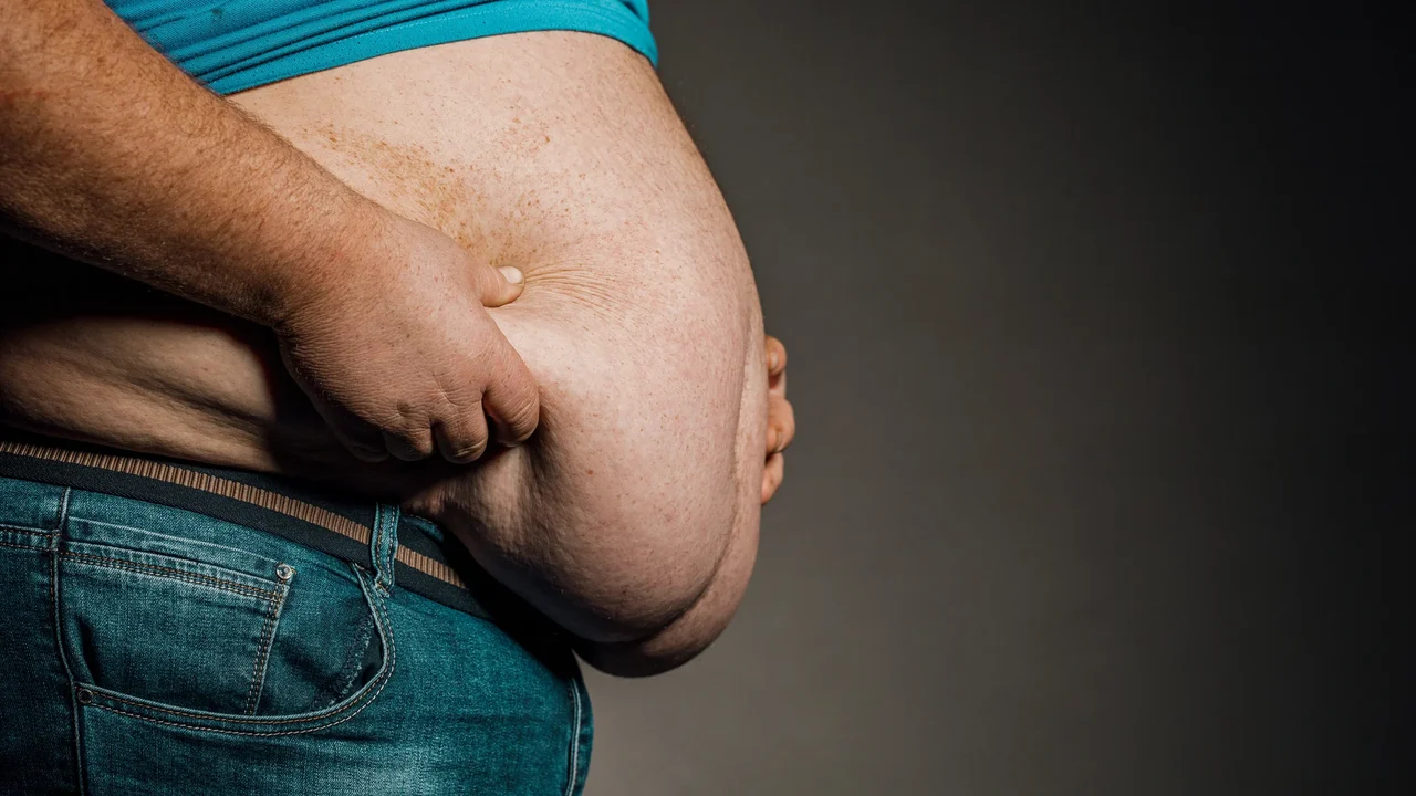 A obesidade está associada a 10% das mortes por infecção em todo o mundo, diz novo estudo da Lancet
