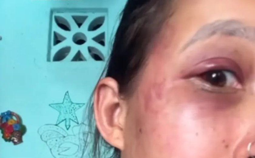 Mulher denuncia companheiro por agressão após recusar relação sexual no Tabuleiro do Martins, em Maceió