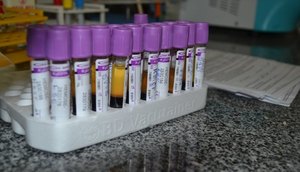 DOAÇÃO DE SANGUE HEMOSE / Foto: Ascom/SES