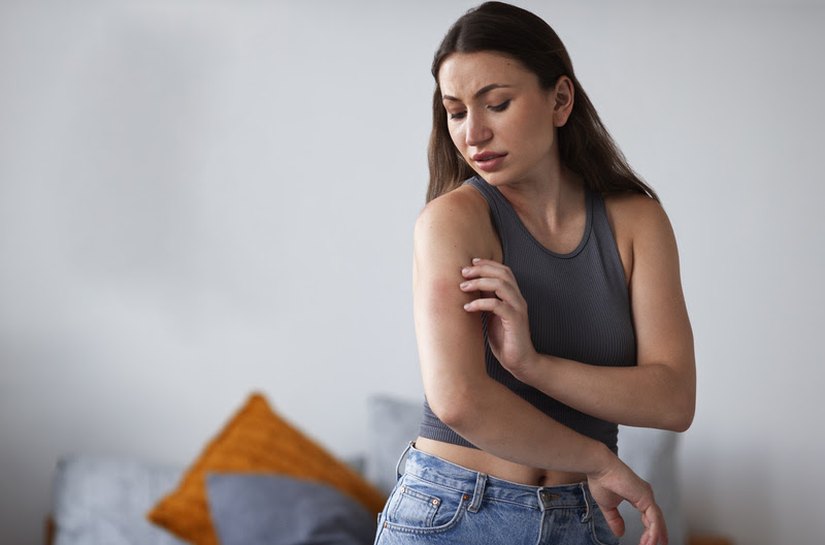 Bicho Geográfico: o que é, cuidados no verão e como identificar os sinais