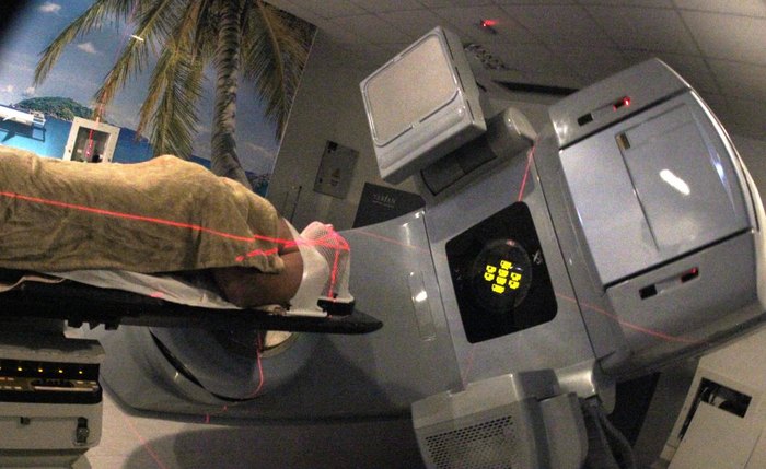 Radioterapia destrói células cancerígenas e, em alguns casos, também pode aliviar sintomas como dor e cansaço