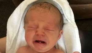 Bebê nasce com dente / Foto: Reprodução Daily Mail