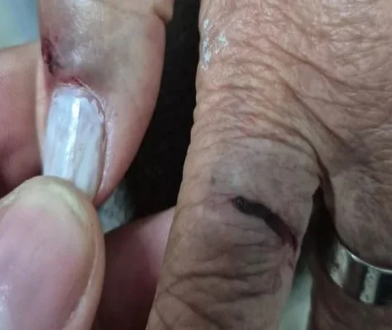 Ministério Público denuncia médica e representa filha adolescente por agressão e lesão contra idosa de 77 anos