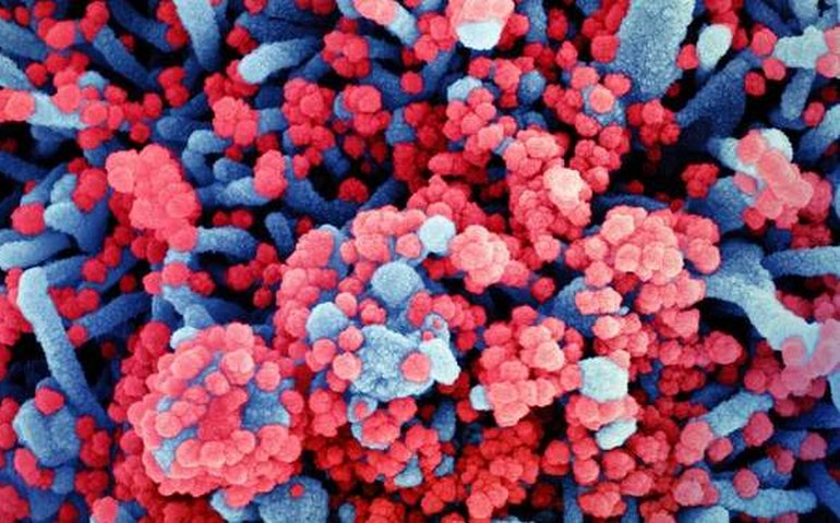 Casaquistão desmente afirmações chinesas sobre novo vírus mortal