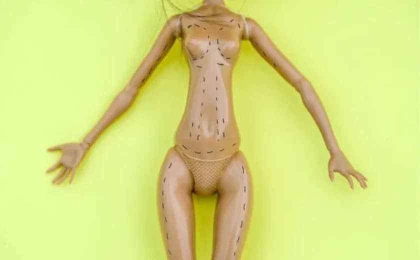 Médico avalia medidas da Barbie caso a boneca fosse real e alerta pais: “45 cm de cintura”