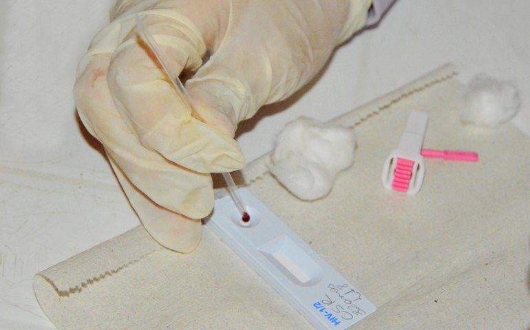 Saúde do Rio instala comitê para atenção aos transplantados com HIV