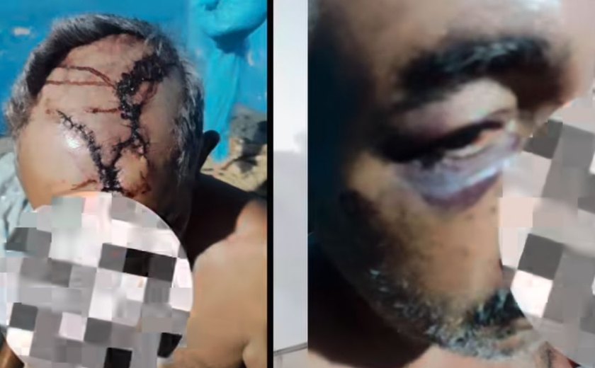 Idoso finge estar morto para sobreviver a espancamento brutal em tentativa de latrocínio em Coruripe