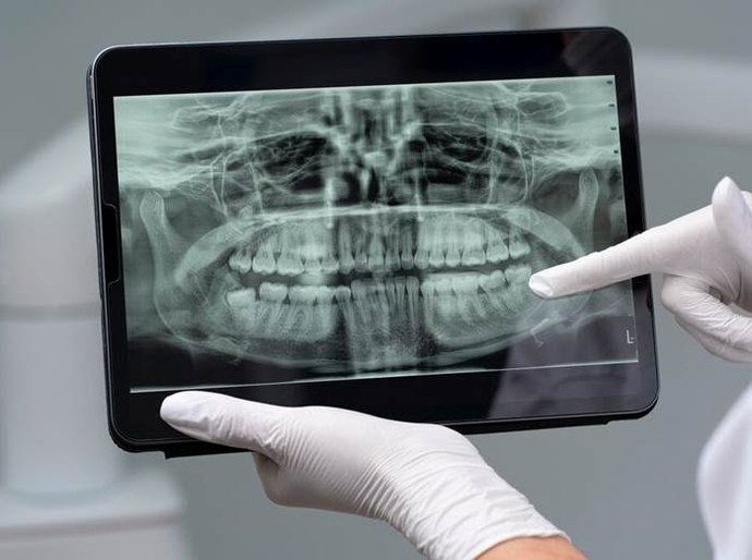Dentes fracos: quais são as causas e como tratar?