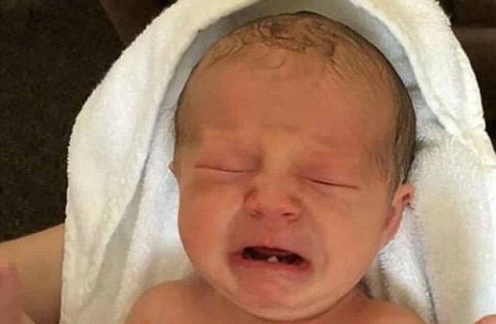 Bebê nasce com dente / Foto: Reprodução Daily Mail