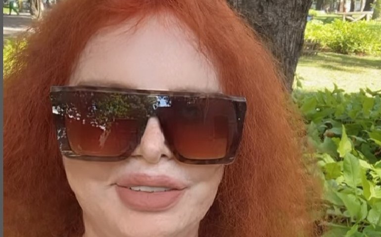 Estrela da década de 1980, Ísis de Oliveira surge com novo procedimento estético no rosto: 'Fica supernatural'