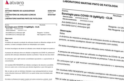 Deputados Antonio Albuquerque e Galba Novaes informam que testaram positivo para o coronavírus